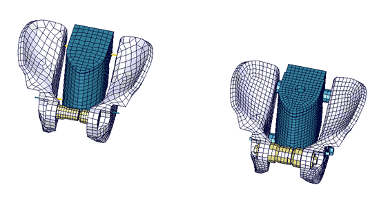 New_pelvis_mesh